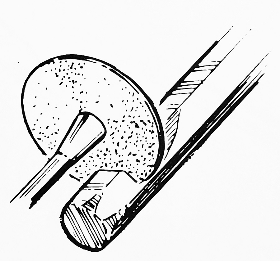 Allen-Key Repair