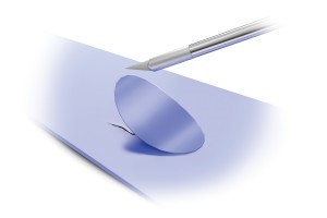 Cutting Corners on Patch Jobs